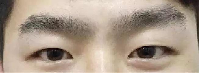 七种不能嫁的男人面相小气刻薄软弱无能没什么出息