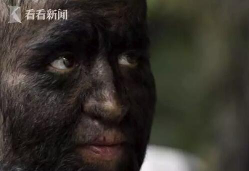 狼人宝宝:16个孩子变成“狼人”只因吃了这种(图)
