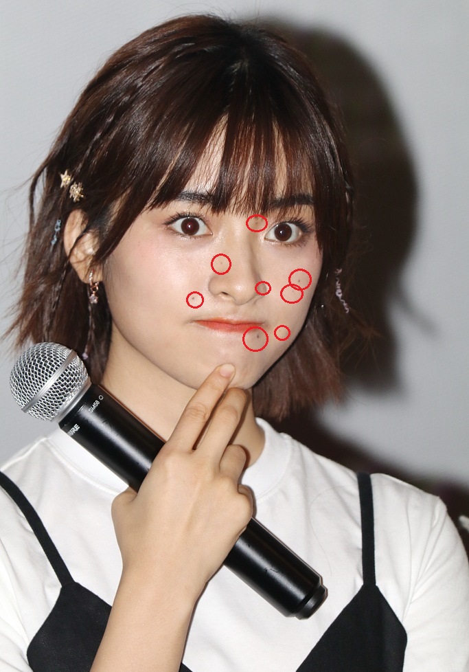 沈月现身粉丝见面会,脸上n颗色素痣颜值成"迷"