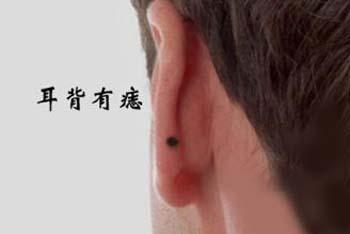 详细分析耳朵有痣的命运好不好左右耳有痣区别很大