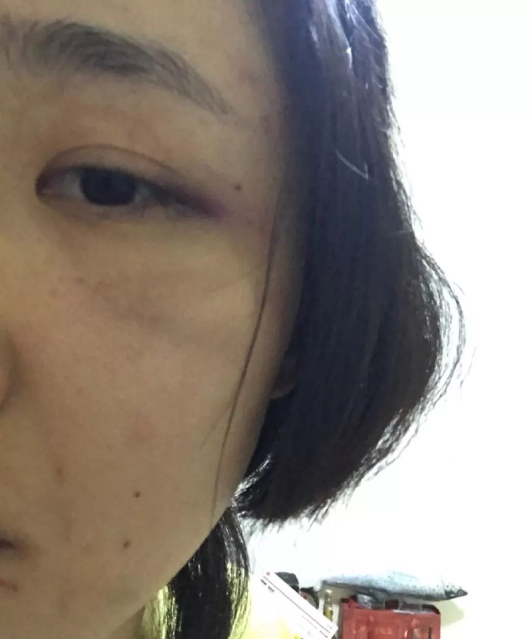光是这些家暴过程就已经看得小8全身冒汗了,女方保存的家暴受伤图更是