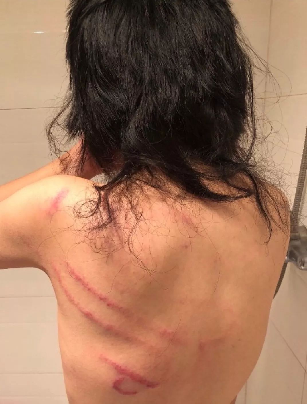又一年轻偶像疑家暴,女方现18处伤痕,掰断手指剪光头发太可怕