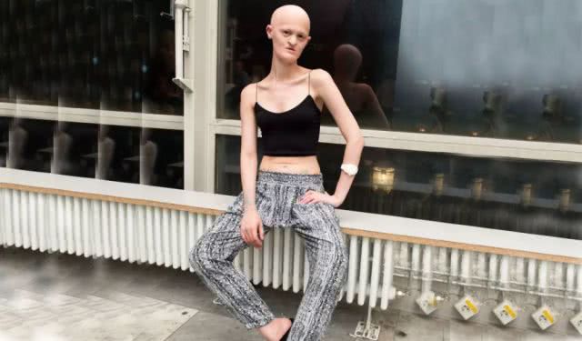 女子天生长得像外星人特殊外貌使她成为时尚界的名模