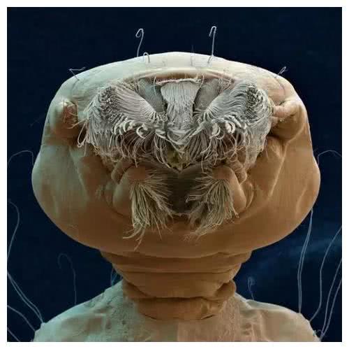 1600倍显微镜下的寄生虫,长的很"恶心",看完整个人不好了