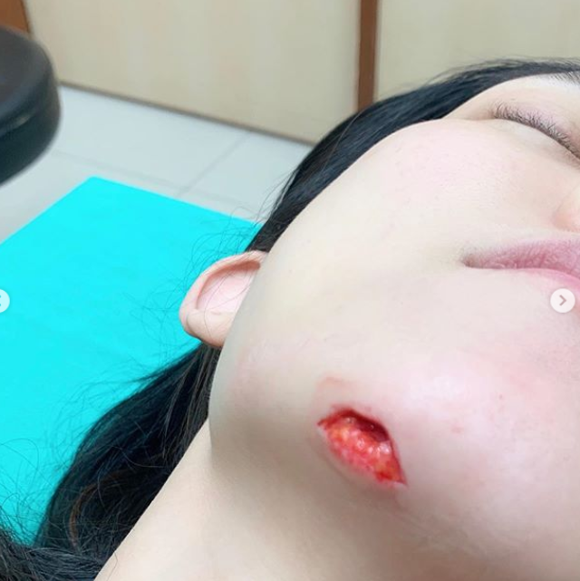 范玮琪刚缝完15针,梁静茹离婚她又发声,网友骂"嘴没缝上"
