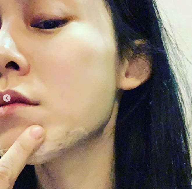 范玮琪刚缝完15针,梁静茹离婚她又发声,网友骂"嘴没缝上"