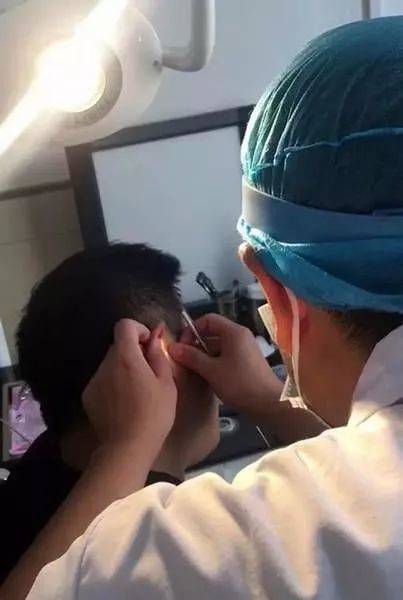 模仿短视频往耳朵里塞大蒜,济南一男子悲剧了