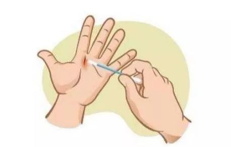 医用酒精、碘伏、红药水、双氧水...哪种处理伤口好？你可能一直都用错了
