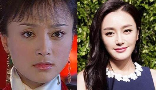 明星整容盘点第一位好可惜而她取出假体更美