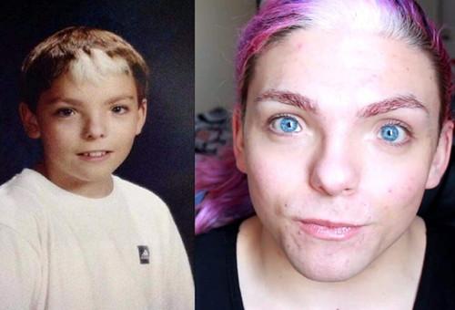 这种遗传病的宝宝天生拥有宝石般的眼睛,却让爸妈们伤心欲绝