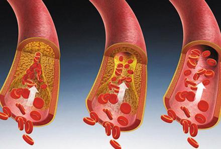 经常拿它做菜,血脂轻松降下来