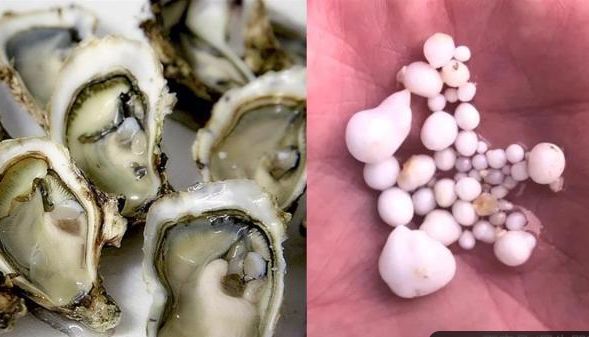 以为吃生蚝牙掉了一次吐出了48颗珍珠能串项链了