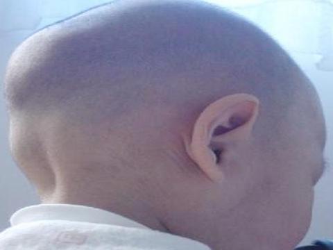 “妈,为啥我是大扁头”毁颜值的事情别再干了,孩子长大后会埋怨|颅骨|审美|小区_新浪新闻