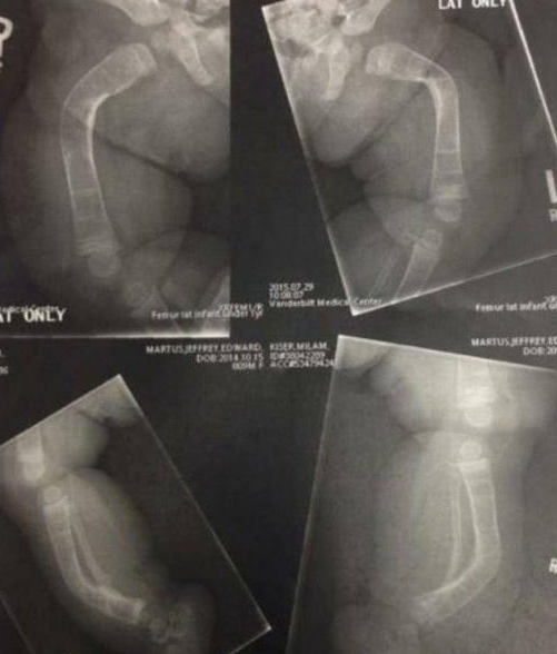 3岁轮椅女孩患骨骼疾病,乐观的她为实现梦想,用独特方式跳芭蕾休闲区蓝鸢梦想 - Www.slyday.coM 3岁轮椅女孩患骨骼疾病,乐观的她为实现梦想,用独特方式跳芭蕾休闲区蓝鸢梦想 - Www.slyday.coM