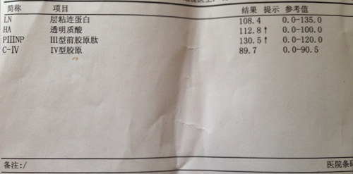 乙肝大三阳肝纤维化,严防肝硬化倾向,兼顾抗纤维化和抗病毒