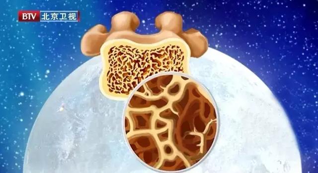 冠脉硬化、钙化,一字之差心梗风险翻倍!如何早