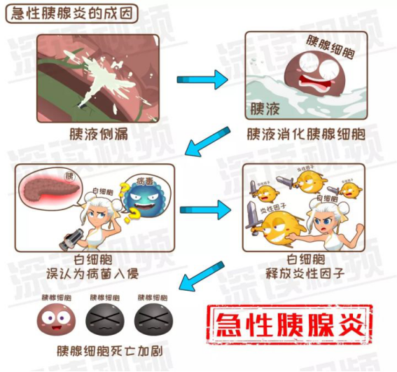 急性胰腺炎死亡率真的很高吗?