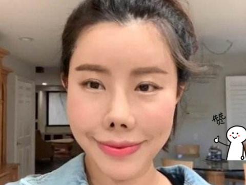 这是什么“审美观”？将自己整成“猪鼻子”，还以为很漂亮？|猪鼻子|审美观|女网_新浪新闻