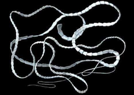 为了观察绦虫身体是如何再生的 科学家将其身体切断__财经头条