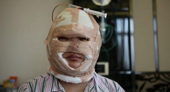 奇葩的男人,多次整容成红骷髅,拆开纱布后妻子直言要离婚