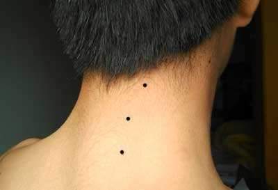 痣相:长在后背的六大富痣,有哪些喻意(图)