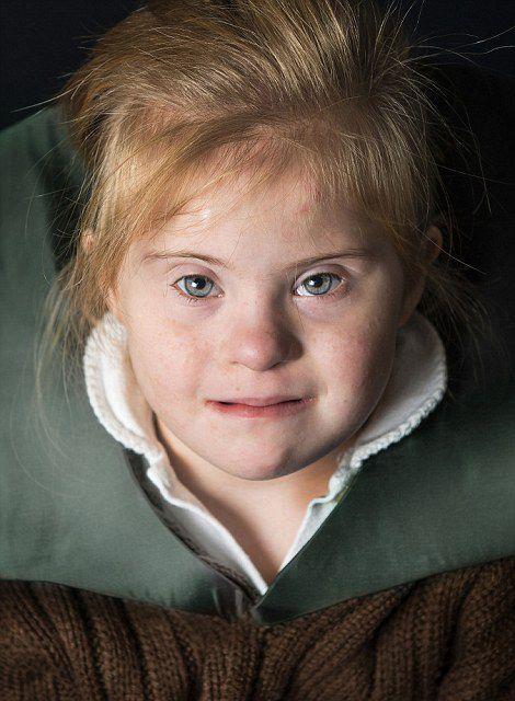 外国夫妇生唐氏双胞胎,努力给娃快乐人生,网友:唐宝也能国际脸