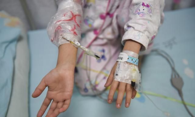 为了输液方便,西西的两个手腕处均放了留置针口,即便如此,她的小手上