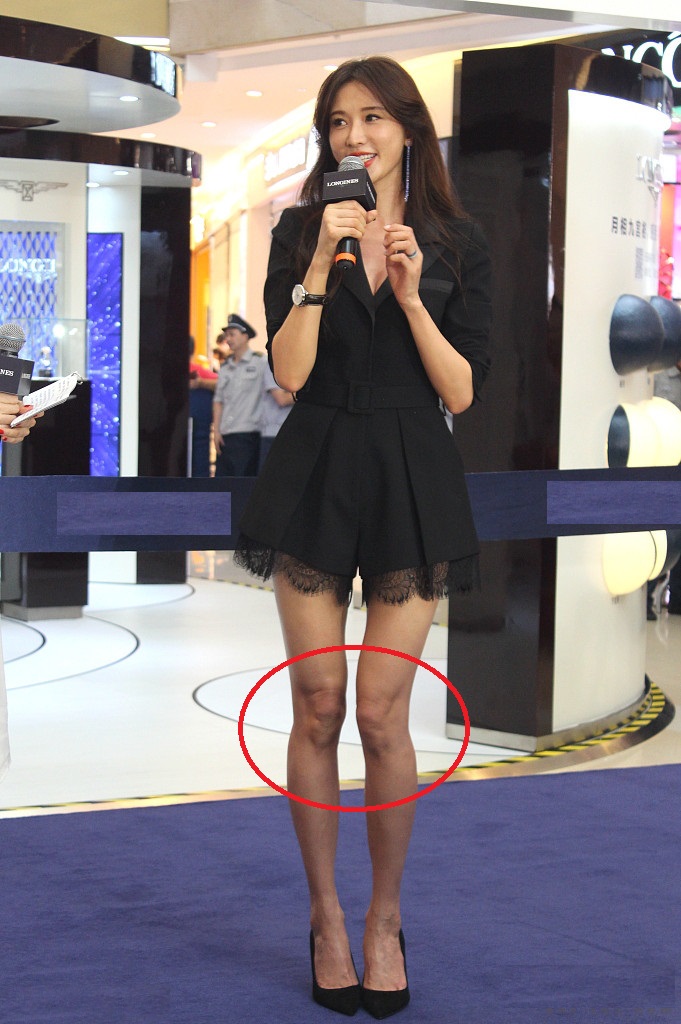 林志玲的大长腿怎么了?"褶皱"多肤色黑,x型腿看着有点怪
