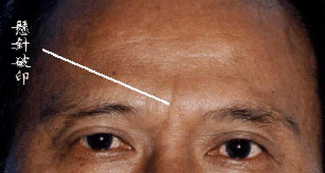 实用面相学,额头上的皱纹是有讲究的,悬针破印不是好面相|面相|祖荫|