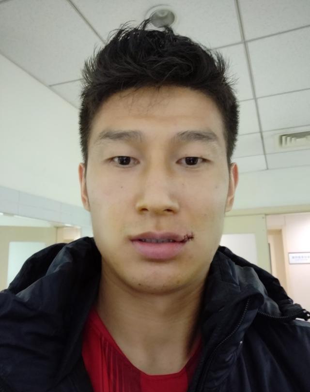 于海嘴角被打出血,张玉宁主动道歉求谅解,于海大度幽默化解尴尬