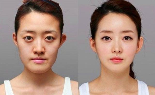 6名韩国女子整容前后照片曝光,整容后如同换了一张脸