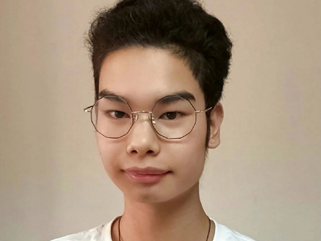 红了1年的"发际线男孩"才赚五十万,网红路还能走多久?