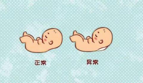 孕早期的nt检查,都检查些什么?