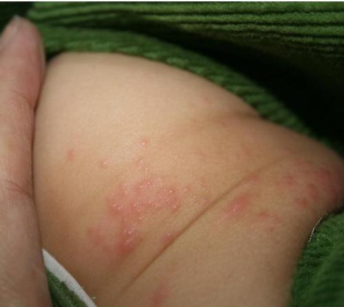 秋冬带娃,家长要改掉3个错误护肤方式,宝宝才能皮肤好,不皴裂