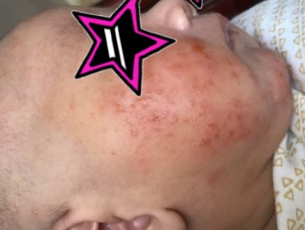 秋冬带娃,家长要改掉3个错误护肤方式,宝宝才能皮肤好,不皴裂