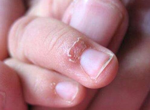 宝宝严重缺锌的5个表现,父母别忽视,快收藏看看你家宝宝有哪个