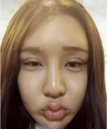 看到以前的样子,网友:真是难为整容医生了