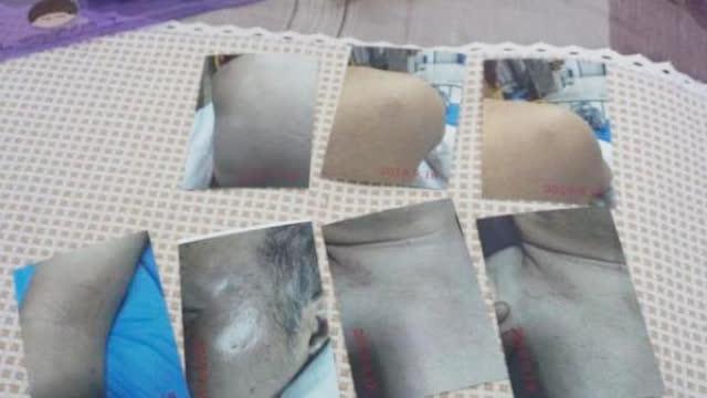 患癌老人被错抓嫖受伤 公安局长登门道歉