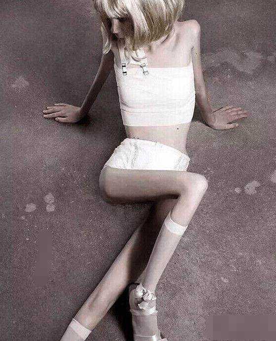 身高170体重50斤的纸片人女孩,看完你还觉得骨感美好吗?