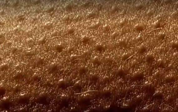 国外一女子做了这样一个有趣的实验,她将皮肤放在显微镜下放大1000倍