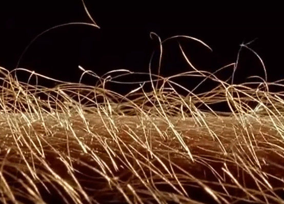 女子将皮肤放大一千倍,画面犹如科幻场面令人惊奇不已!