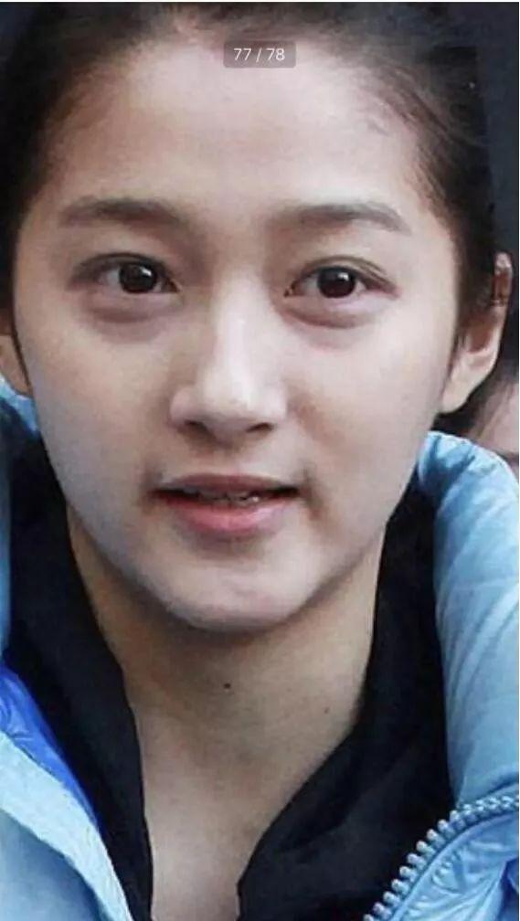 关晓彤年龄轻轻眼袋怎么这么重看起来比鹿晗老了很多