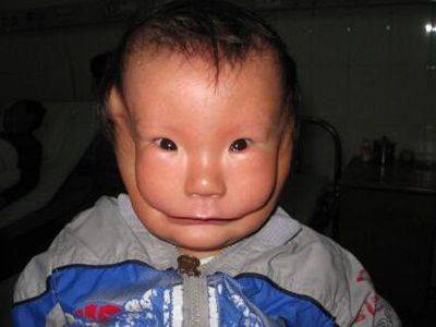 江西有个面具娃娃出生时体重就异于常人也并没有戴面具