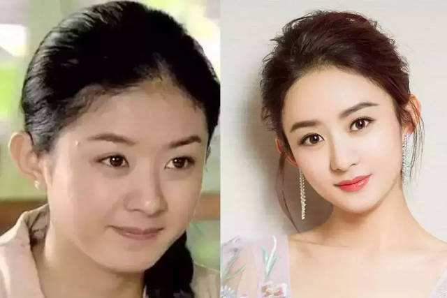 赵丽颖产后脱发?《有翡》《楚乔传》造型对比发际线高低一目了然