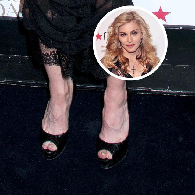 看了这17位美女明星的脚你可能会觉得高跟鞋是个坏东西