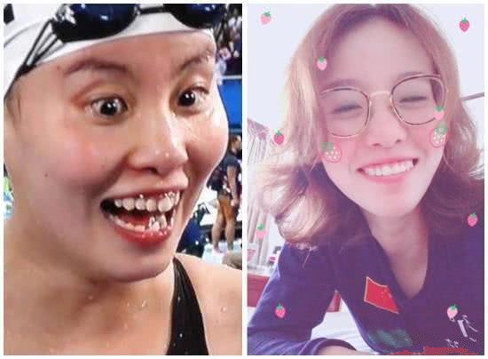 不比不知道孙杨傅园慧整牙后颜值爆升难怪有人说整牙如整容