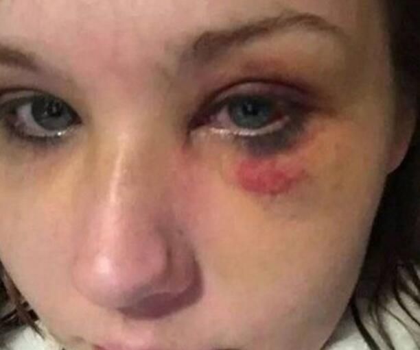 女儿被男友打得鼻青脸肿,丈母娘想找女婿讨说法,不料却爱上女婿