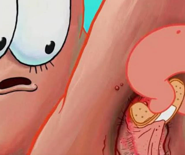 派大星"毛发"有多旺盛?4张图片我看吐了,头皮发麻浑身痒!