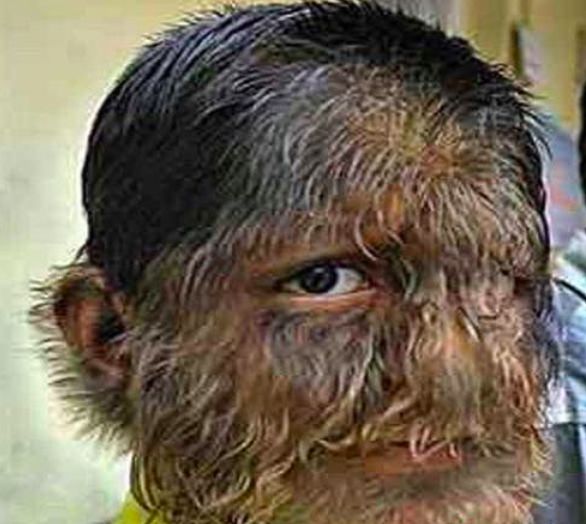 人类会发生的"返祖现象", 这几种情况你们见过吗?