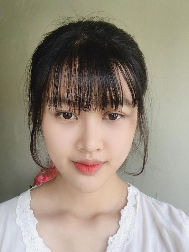 女大学生因下巴长从小遭同学嘲笑,整容后变漂亮被众多男生追求